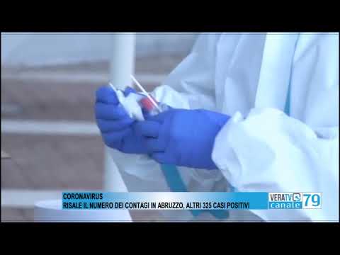 Coronavirus – Aumentano di nuovo i contagi in Abruzzo, altri 325 casi positivi