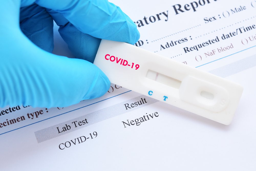Report Coronavirus: 140 nuovi casi e due decessi in Abruzzo