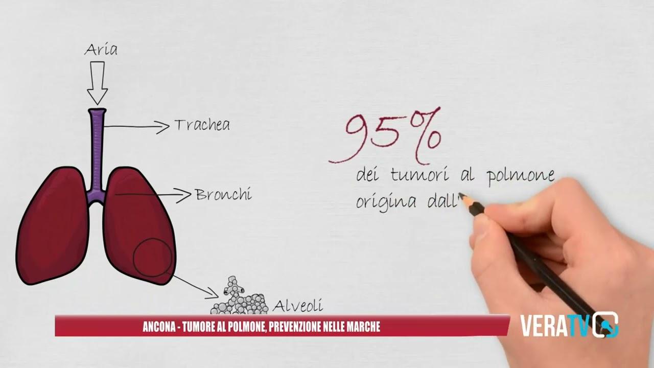 Ancona – Tumore al polmone, prevenzione nelle Marche