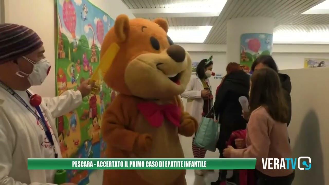 Pescara – Accertato il primo caso di epatite infantile