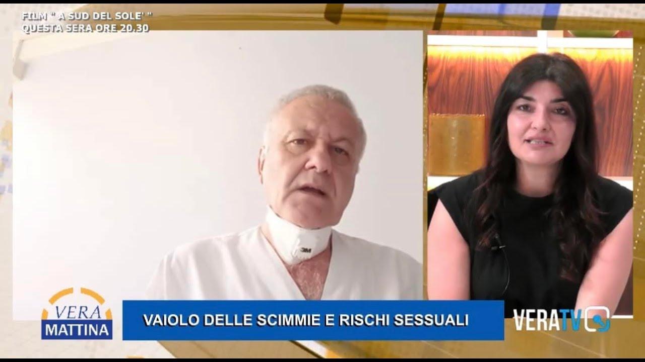 Vera Mattina – Vaiolo delle scimmie e rischi sessuali