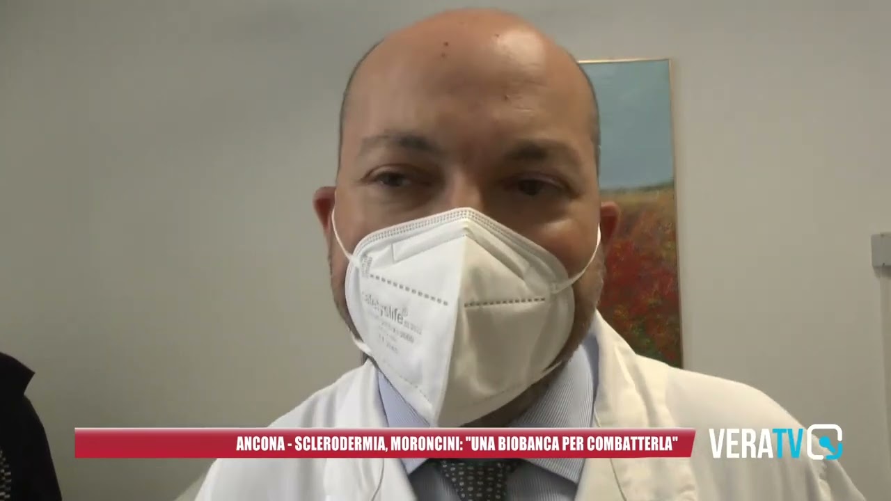 Ancona – Sclerodermia, Moroncini:”Una biobanca per combatterla”