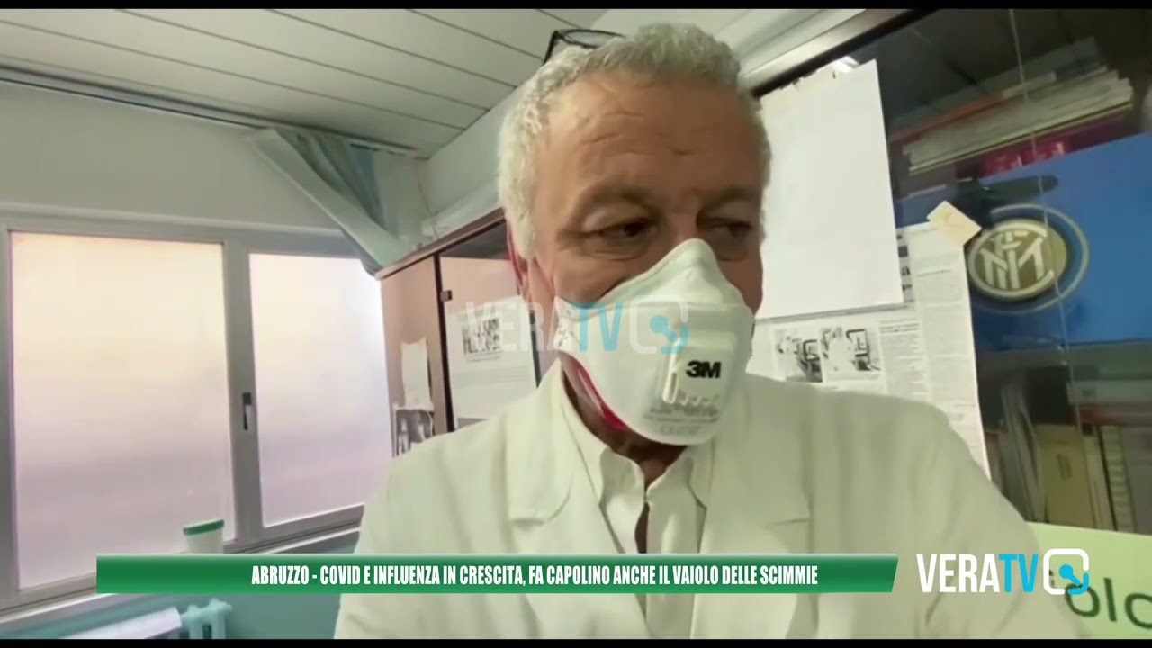 Abruzzo – Covid e influenza, dati in crescita: fa capolino anche il vaiolo delle scimmie